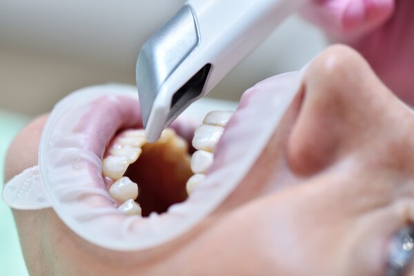 Проведение 3D снимка зубов